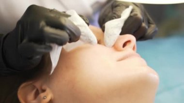 Doktor, kadının yüzündeki sivilceleri çıkartıyor. Siyah eldivenli eller steril süngerleri tutar ve açık tenli sivilceleri temizler. Lamba ve büyüteç, yüzü aydınlatır. Cilt temizleme işlemi