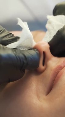 Doktor, kadının yüzündeki sivilceleri çıkartıyor. Siyah eldivenli eller steril süngerleri tutar ve açık tenli sivilceleri temizler. Lamba ve büyüteç, yüzü aydınlatır. Cilt temizleme işlemi