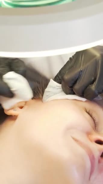 Doctor squeezes out pimples on face of woman. Hands in black gloves hold sterile sponges and remove dirt and pimples from fair skin. Lamp and magnifying glass illuminate face. Skin cleansing procedure — Stock Video