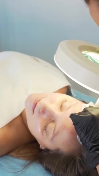 Doctor squeezes out pimples on face of woman. Hands in black gloves hold sterile sponges and remove dirt and pimples from fair skin. Lamp and magnifying glass illuminate face. Skin cleansing procedure — Stock Video