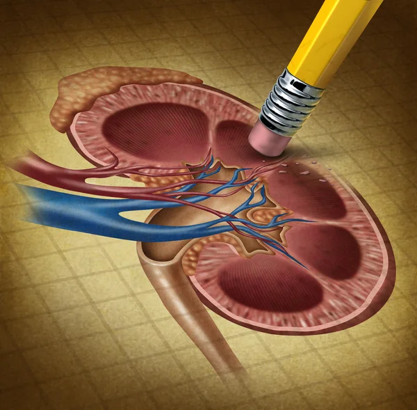 Perder a saúde renal — Fotografia de Stock