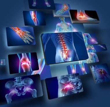 Human Joints Concept clipart