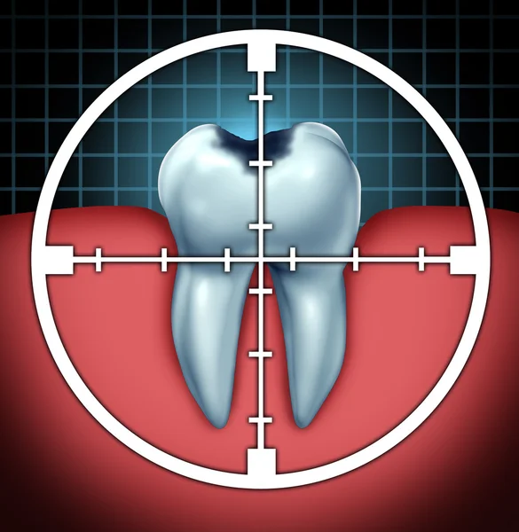 Leküzdeni a fogszuvasodás — Stock Fotó