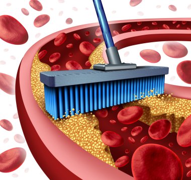 Cleaning Arteries clipart