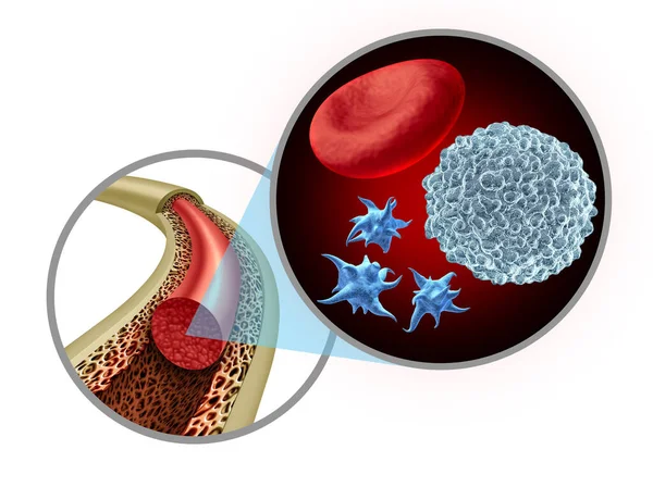 Beenmerg Bloedcellen Als Bloedplaatjes Witte Bloedcellen Concept Een Gezonde Anatomie — Stockfoto