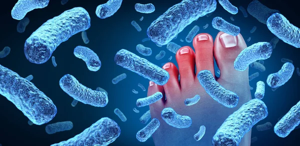 足部细菌疾病作为人体产生难闻气味的一种疾病 显示出脚趾带有细菌性感染的危险 是皮肤疾病的标志 是一种足部疾病 也是一种带有3D插图元素的蓝色背景下的小儿医学概念 — 图库照片