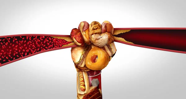 Artery Disease Food Causing Arteriosclerosis Clogged Arteries Human Vein Hand — Stock Photo, Image