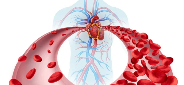 Анемия Анемия Медицинская Диаграмма Понятие Ненормальное Нормальное Количество Клеток Крови — стоковое фото