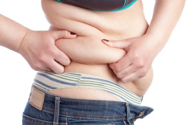 şişman kadın mide kalın bir katman alır. Beyaz bir arka