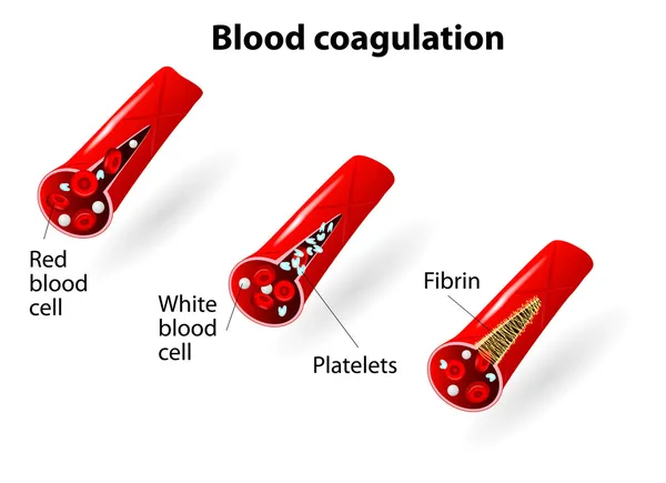 Blodkoagulering — Stock vektor