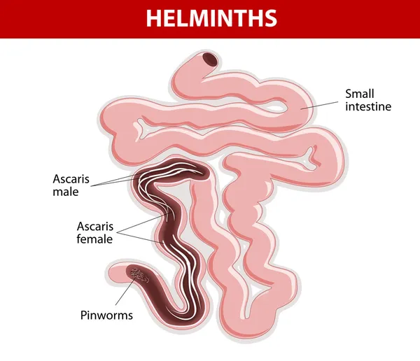 Helminths on Small intestine — Stock Vector