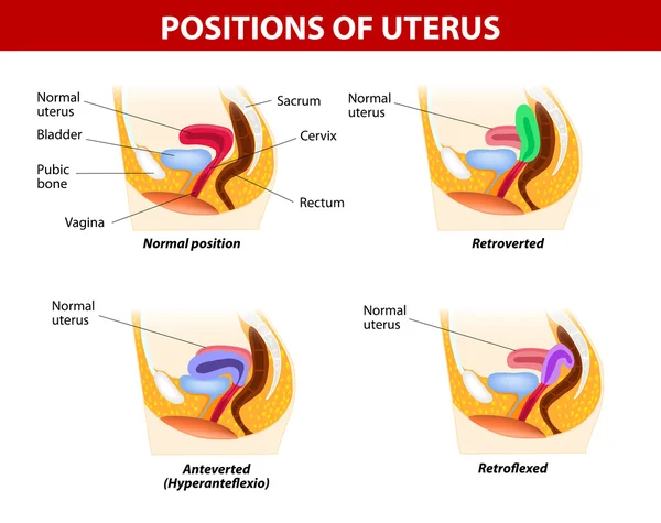 Posizioni dell'utero — Vettoriale Stock