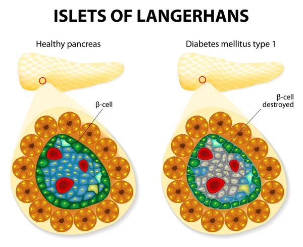 胰岛细胞的作用 — 图库矢量图片