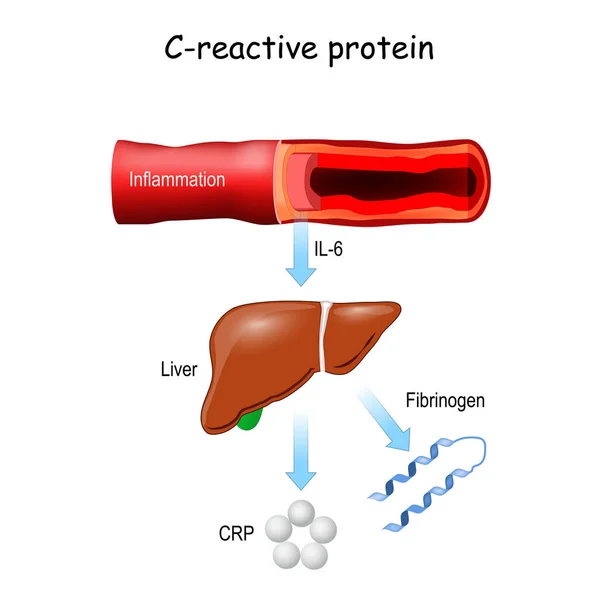 Reactive Protein Pro Inflammatory Cytokine Inflammation Blood Vessel Liver Release — Stock Vector