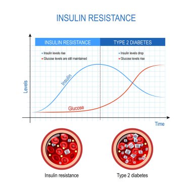 Insulin resistance and Type 2 diabetes. comparison and difference. high blood sugar. Chart with insulin and glucose levels. Cross section of blood vessel. Vector diagram clipart