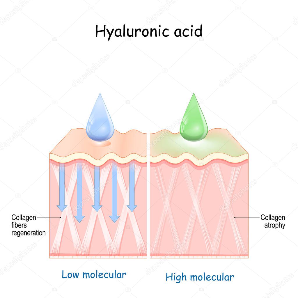 Hyaluronic acid. skin rejuvenation with help of skin-care products. Low molecular and High molecular