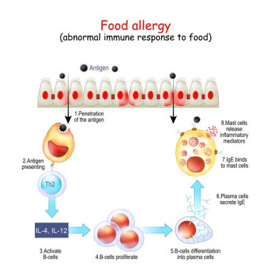 Food allergy. abnormal immune response to food. Reaction of immune system from Penetration of the antigen and B-cells Activation to IgE secretion and release inflammatory mediators of Mast cells. Vector poster for education clipart