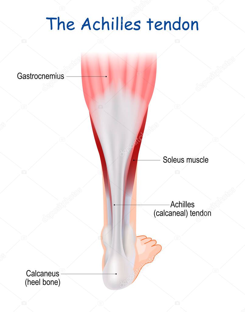 The Achilles tendon serves to attach the plantaris, gastrocnemius (calf) and soleus muscles to the calcaneus (heel) bone. heel cord or calcaneal tendon. Human leg. Medical infographic