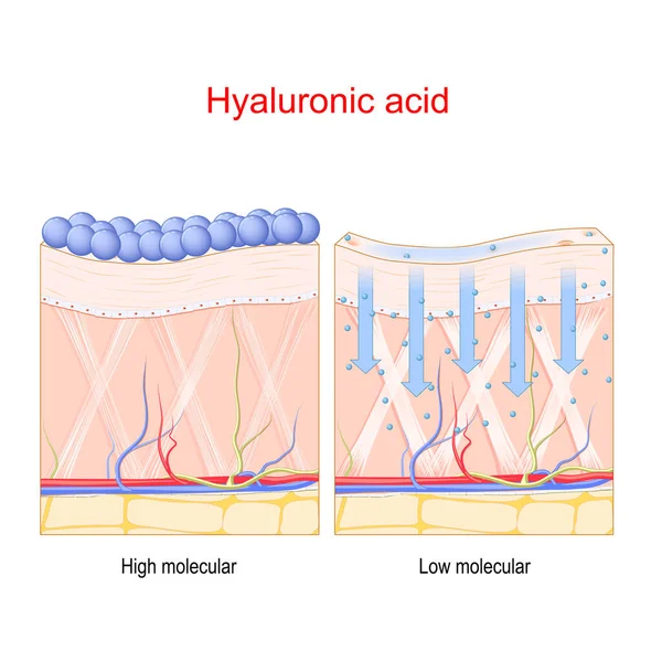 ヒアルロン酸 低および高分子ヒアルロン酸の皮膚への浸透 皮膚ケアとアンチエイジング治療に関するベクトルポスター — ストックベクタ
