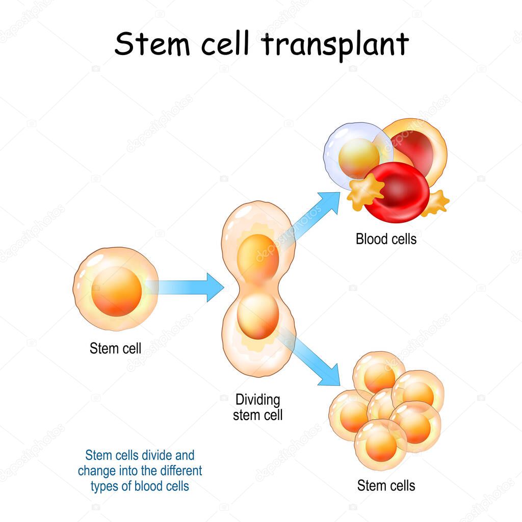 Stem cell transplant. Stem cells divide and change into the different types of blood cells. Vector illustration