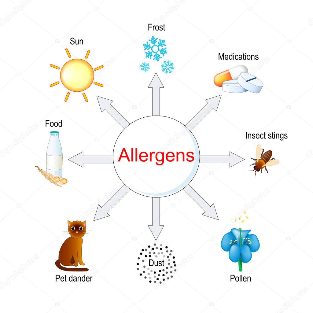 Types of allergens. Vector illustration