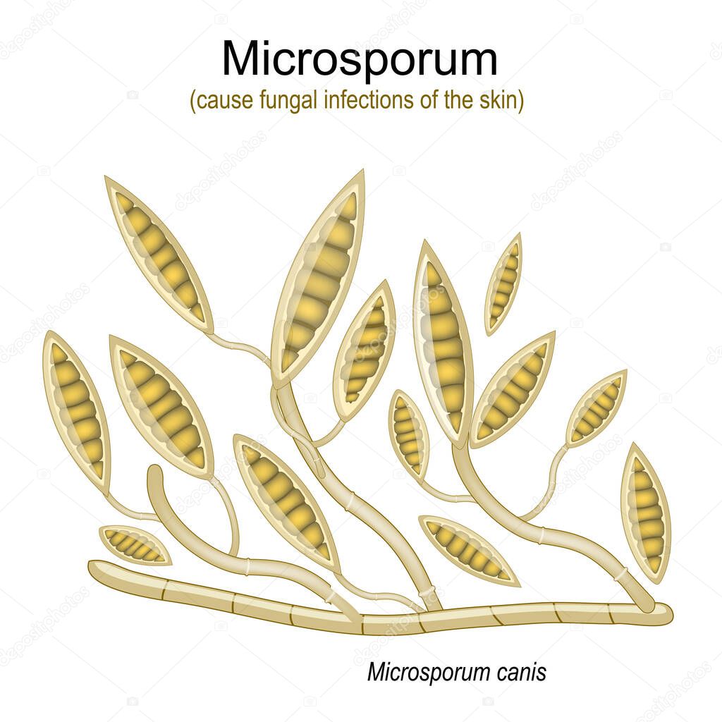 Microsporum, under microscope. Microscopic fungi that cause infections of scalp, skin of body and feet. vector  illustration