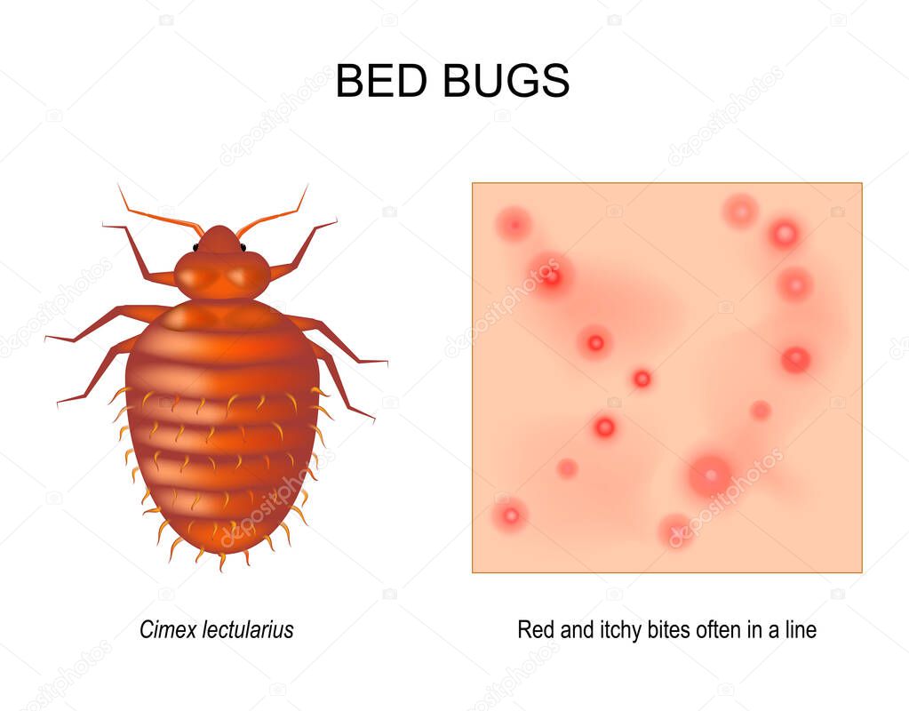 bed bug. adult female of Cimex lectularius. Close-up of skin with Red and itchy bites that often in a line. magnification of an insect. top view of a Bedbug. vector illustration