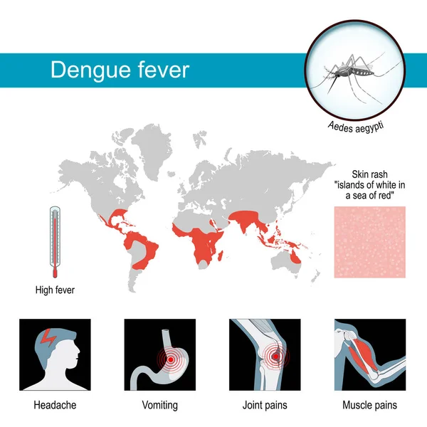 Dengue Láz Tünetei Infografika Figyelemfelkeltő Poszter Járványos Dengue Térképei Közelkép — Stock Vector