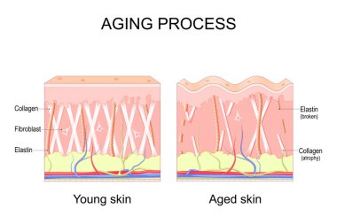 Aging process. comparison of Young and aged skin. Collagen, Elastin and fibroblasts in younger and older skin. age-related changes in the skin when Collagen fibers atrophy, and Elastin broken. Vector illustration