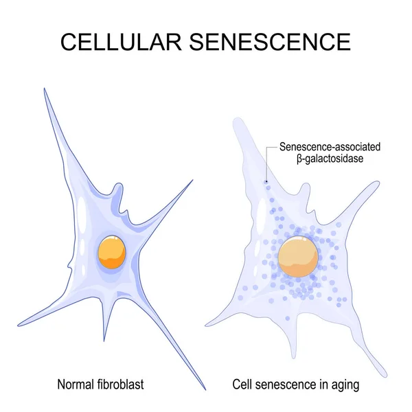 Cellular Senescence Changes Senescent Cells Ageing Comparison Difference Normal Fibroblast — Vector de stock