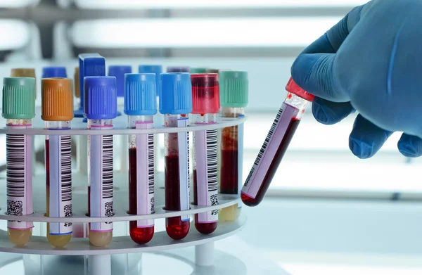 Blood tubes for centrifuging — Stock Photo, Image