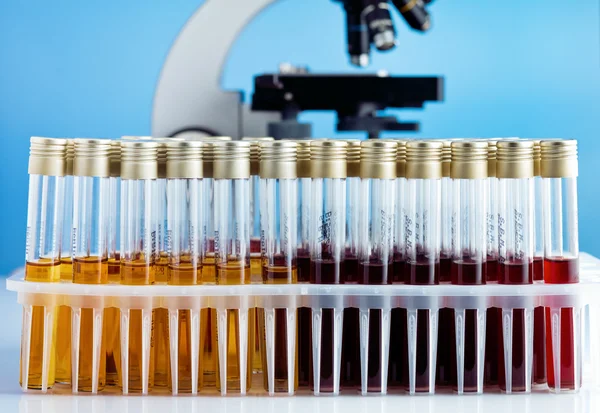 Microscópio e tubos com meio líquido em laboratório — Fotografia de Stock