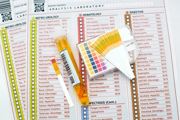 Urinalysis — Stock Photo, Image