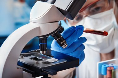 Mikrobiyoloji laboratuvarında yeni bir tür koronavirüs olan kan tüplü bir doktor. Mikroskopist bilim adamı laboratuvarda mikroskop altında kan örneğini inceliyor.