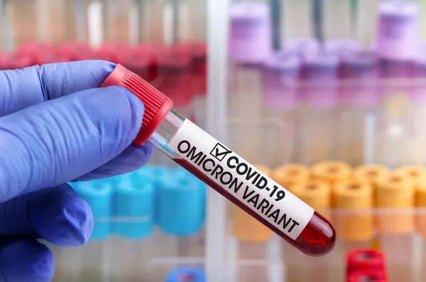 Yeni Covid-19 Omicron B1.529 kan örneği ve covid-19 Coronavirus Mutasyonları 'nın genel verilerini içeren bir doktor. Analiz laboratuarındaki araştırmacıda yeni tür Omicron örneği var.