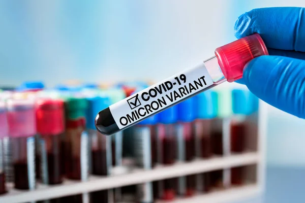 Onderzoeker Analyselab Met Monster Van Nieuwe Stam Van Coronavirus Mutaties — Stockfoto