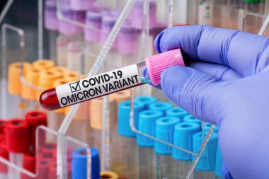Coronavirus Mutasyonları 'nın yeni bir türü olan Omicron B.1.529. Omicron adında Covid-19 'un yeni varyasyonunun kan örneğini içeren teknisyen laboratuvarı.