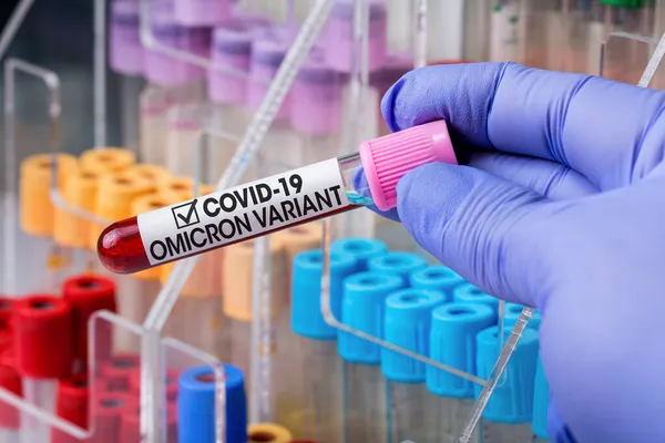 Doctor in analysis laboratory holding sample of new strain of Coronavirus Mutations Omicron B.1.1.529. Technician labwith blood sample of New Variant of Covid-19 called Omicron