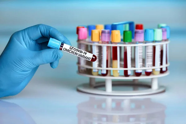 Researcher Lab Holding Sample New Strain Coronavirus Mutations Omicron Doctor — Stock Photo, Image