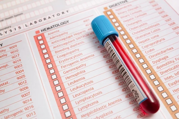 Tube Blood Sick Patient Blood Checkup Blood Sample Medical Report — Stock Photo, Image