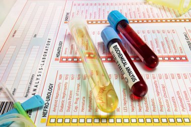 Biyokimyasal analiz için bir hastanın tüp biyolojik örnekleri ve tıbbi test talebi. Biyokimyasal analiz için kan ve idrar örnekleri içeren tüpler.