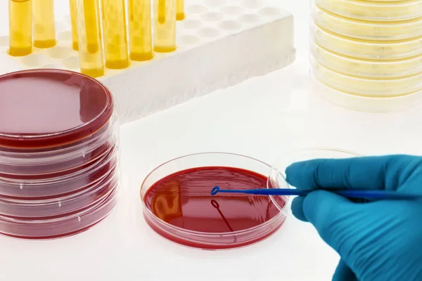 Petri Dish Analysis Biological Samples Microbiology Laboratory Culture Urine Petri — Stock Photo, Image