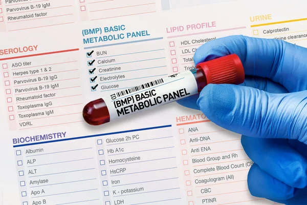 Blood Sample Tube Analysis Bmp Basic Metabolic Panel Laboratory Blood — Stock Photo, Image