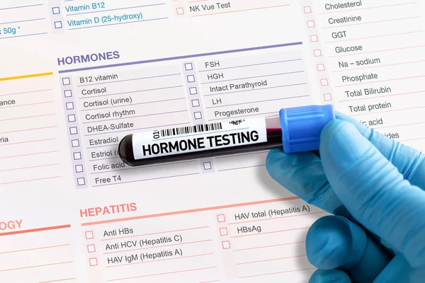 Blutprobenröhrchen Zur Analyse Von Hormonen Labor Blutröhrchen Test Mit Anforderungsformular — Stockfoto