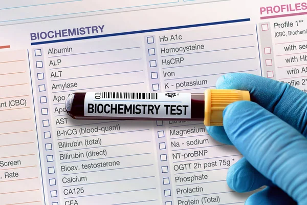 Blutprobenröhrchen Zur Analyse Der Biochemie Labor Blutröhrchen Test Mit Beschlagnahmeformular — Stockfoto