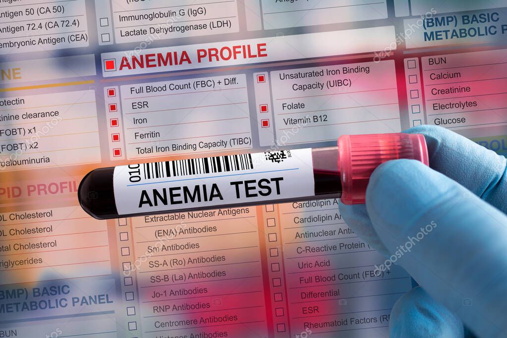 Tubo de muestra de sangre para el análisis del perfil de anemia en
