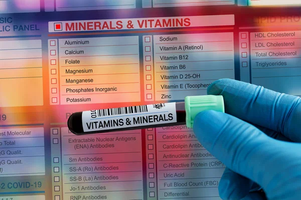Blutprobenröhrchen Zur Analyse Von Mineralstoffen Und Vitaminen Der Leberfunktion Labor — Stockfoto
