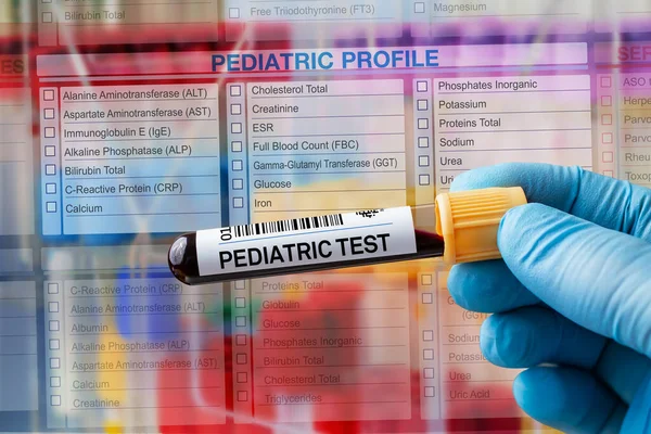 Analiz Için Kan Örneği Tüpü Laboratuvarda Pediatrik Test Için Talep — Stok fotoğraf