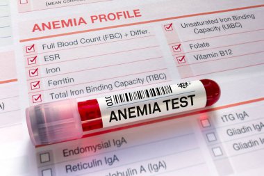 Anemi testi için talep formu içeren kan tüpü testi. Laboratuvarda anemi profil analizi için kan örneği tüpü.