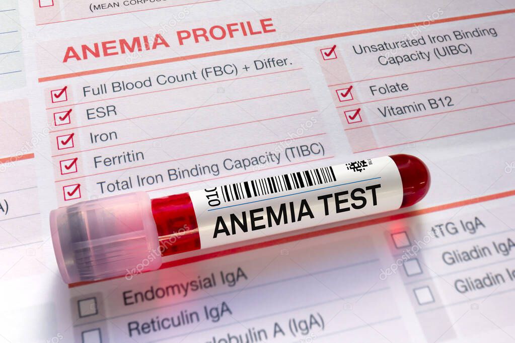 Prueba del tubo sanguíneo con forma de requisición para la prueba de